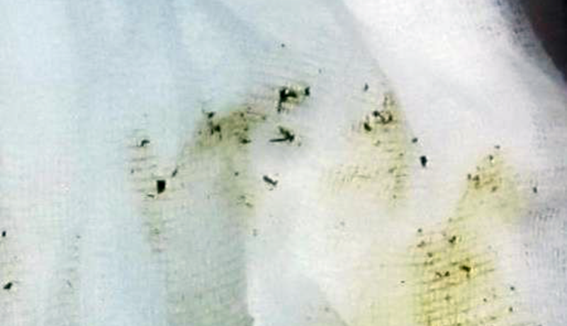 Hreinir spenaendar = lægri frumutala!